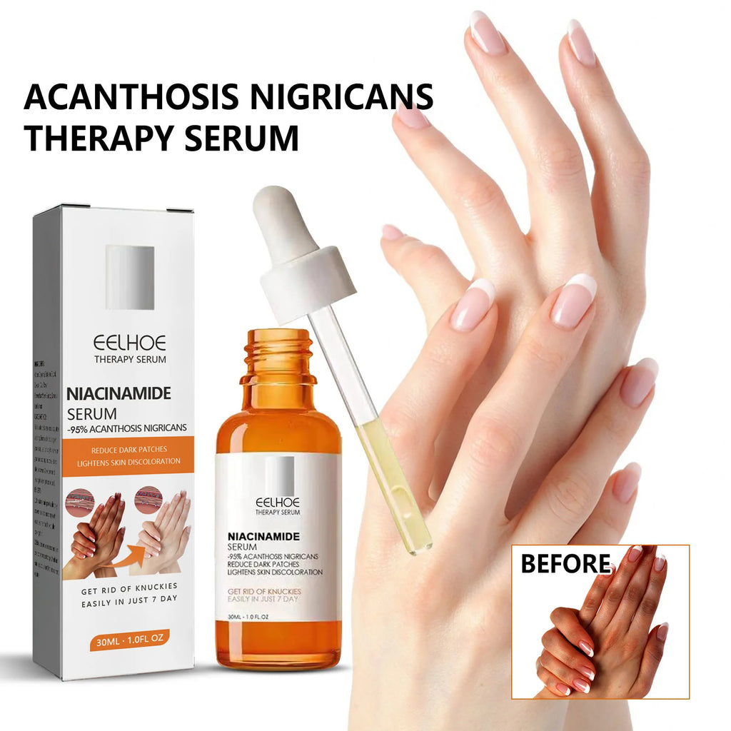 Dark Knuckles Whitening Serum Dark Knees Elbow Lightening Pigmentation Corrector Hand Knuckle Glow Intense Stains Remover Serum