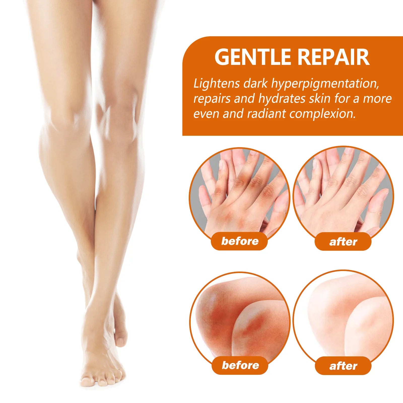 Dark Knuckles Whitening Serum Dark Knees Elbow Lightening Pigmentation Corrector Hand Knuckle Glow Intense Stains Remover Serum
