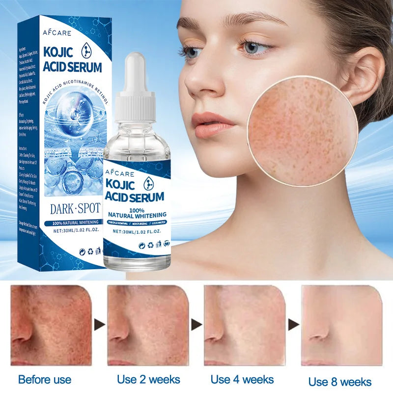 Kojic Acid Fades Freckle Dark Spot Face Serum with Niacinamide and Vitamin E for Quick Brightening Nourishing Skin Care Product