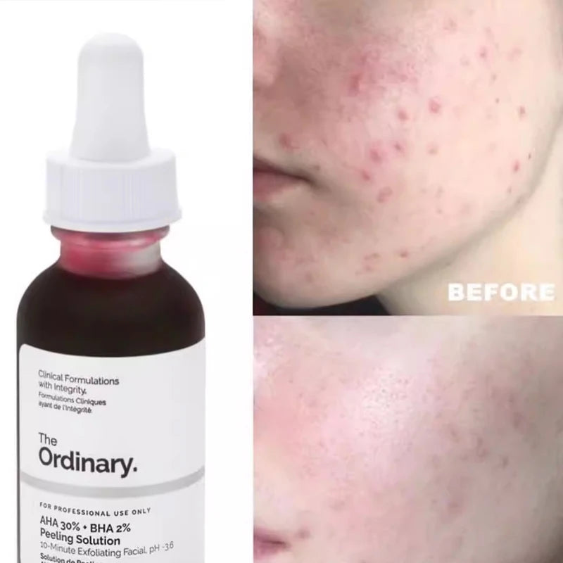 Hyaluronic Acid 2%+B5 Hydrating Serum Iacinamide 10%+Zinc 1% Serum 30ml AHA 30% + BHA 2% Peeling Solution 30ml Improve The Skin