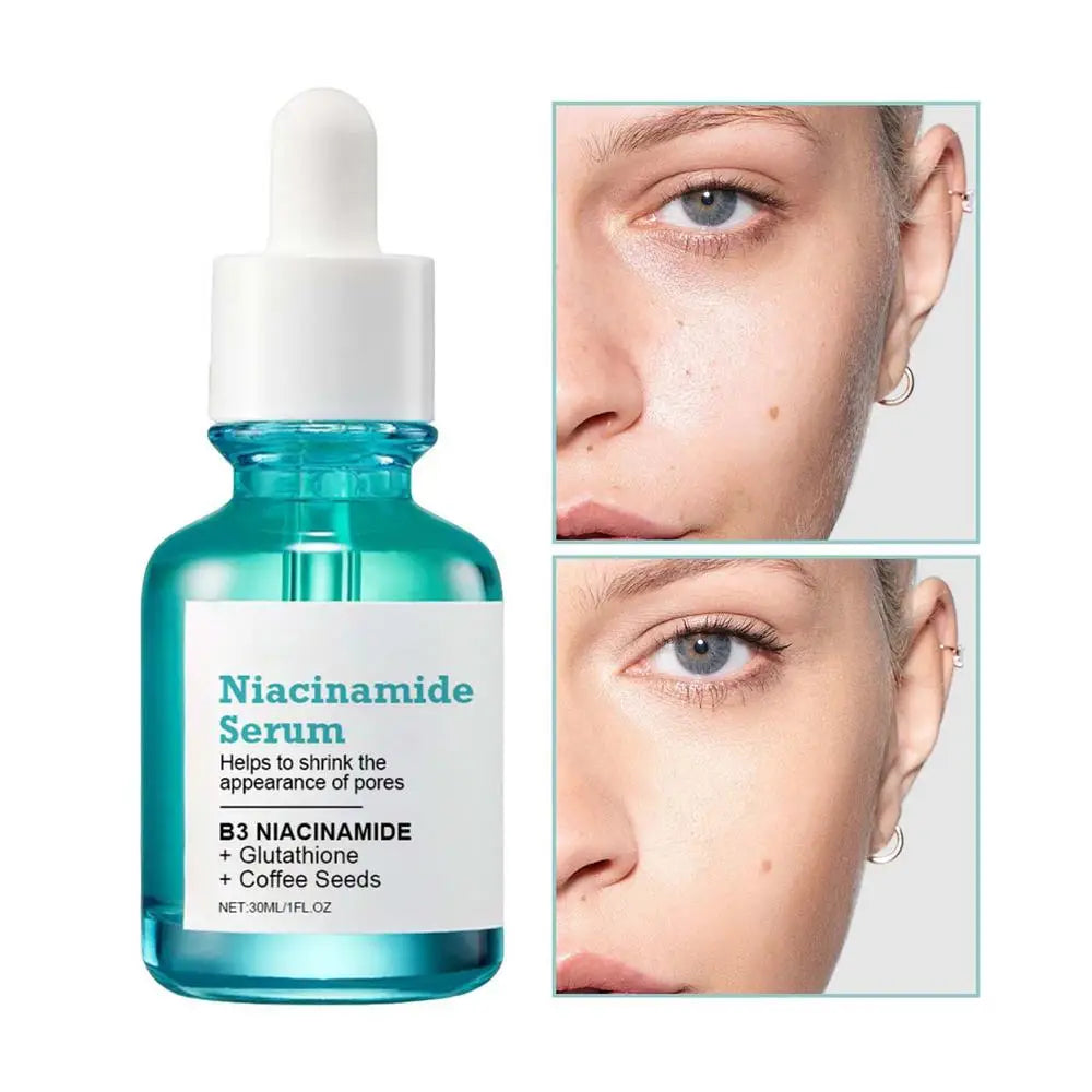 Niacinamide Serum Hyaluronic Acid Moisturizing Niacinamide Facial Serum Whitening Dark Spots Removal Rejuvenation Serum 30ml