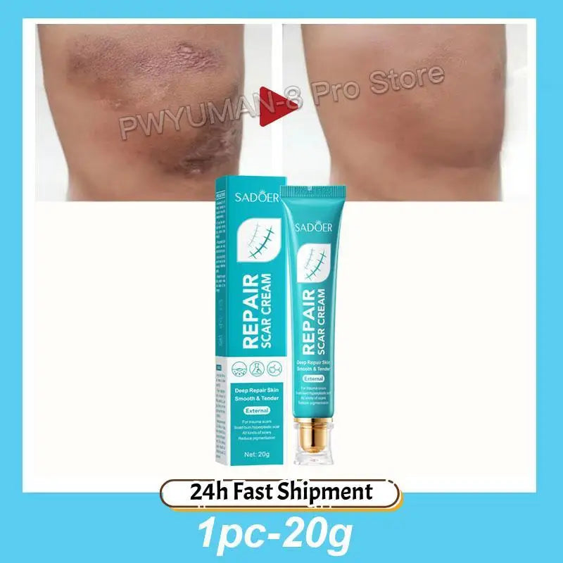 Fast Scar Removal Cream Treatment Stretch Marks Burn Surgical Scar Acne Spots Repair Gel Whitening Moisturizing Smooth Skin Care