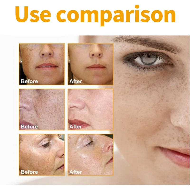 Turmeric for Face Cream Dark Spots Removal Whitening Facial Cream Lightening Improve Dullness Skin Care Products Beauty Health