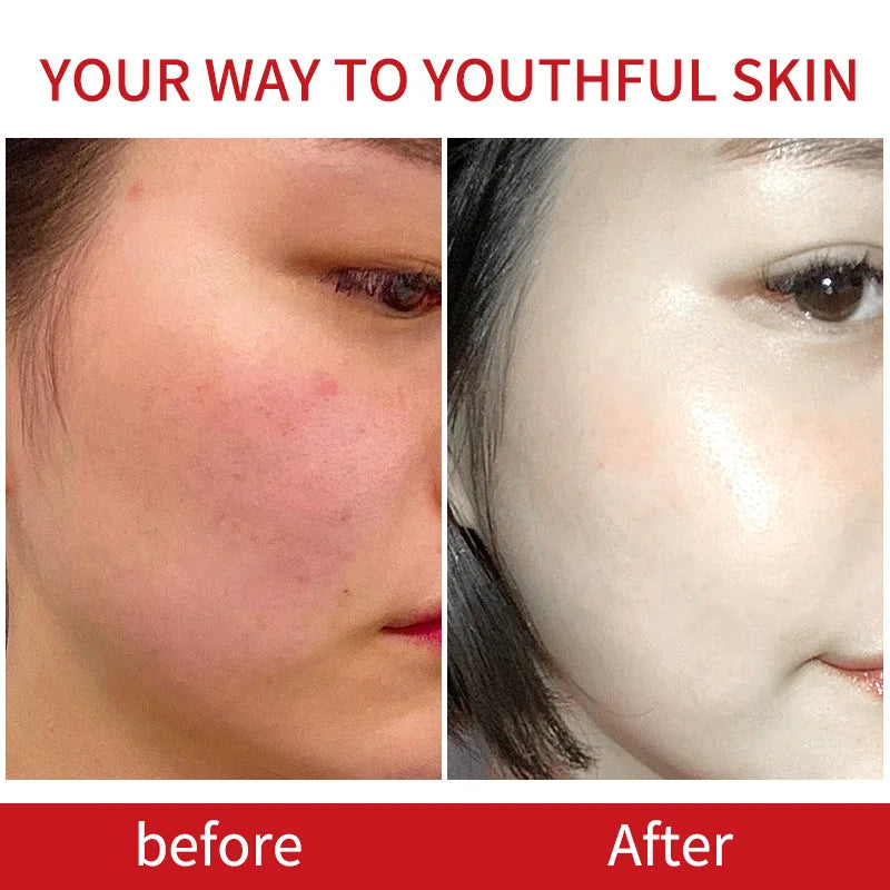 Collagen Serum Set with A Free Oxygen Sprayer Moisturizing Nourishing Anti-wrinkle Skin Care Product