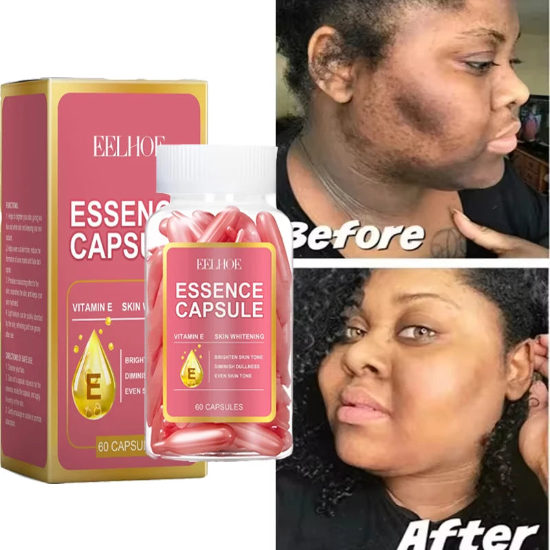 كبسولات فيتامين E لتفتيح البشرة – تقليل التصبغات والبقع الداكنة