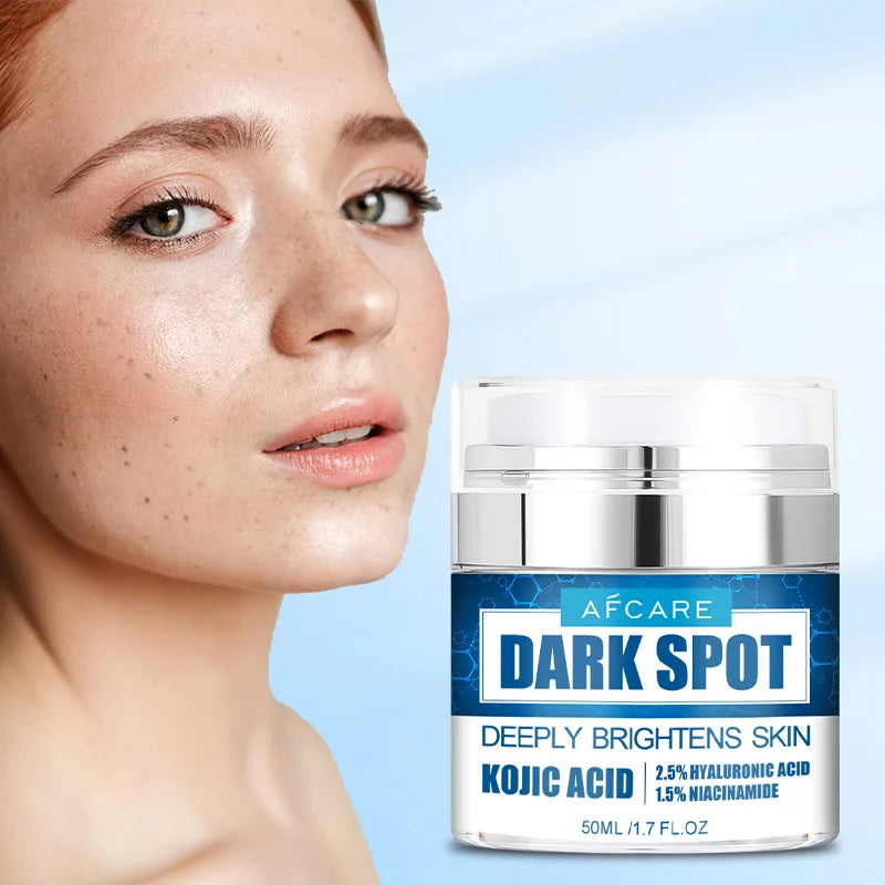 Dark Spots Remove Kojic Acid Cream Face Nicotinamide Effective Whiten Anti-pigmentation Improve Dullness Skin Care Cream 50ML