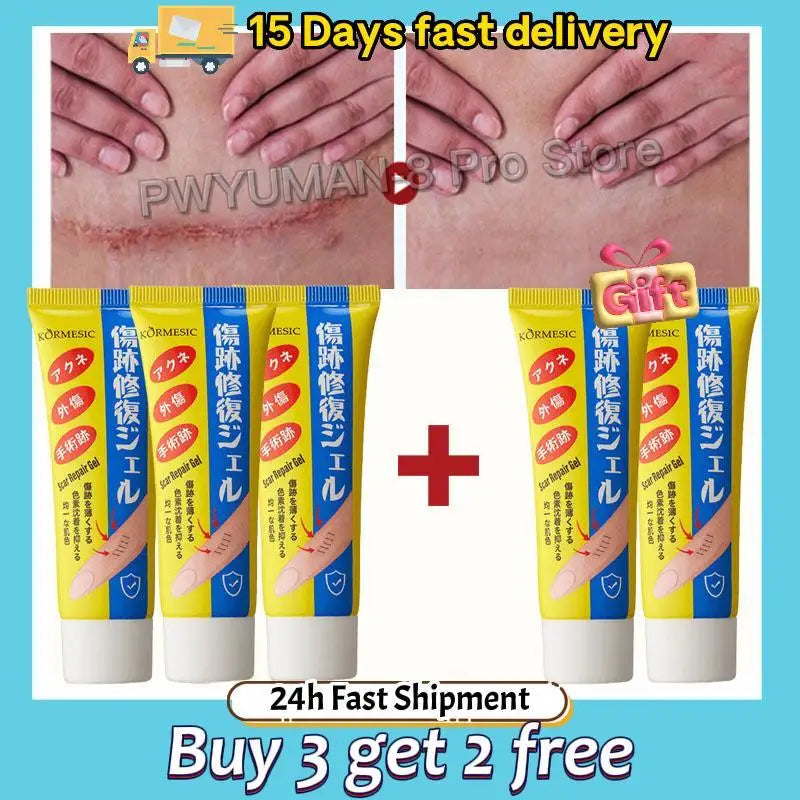 Fast Scar Removal Cream Treatment Stretch Marks Burn Surgical Scar Acne Spots Repair Gel Whitening Moisturizing Smooth Skin Care