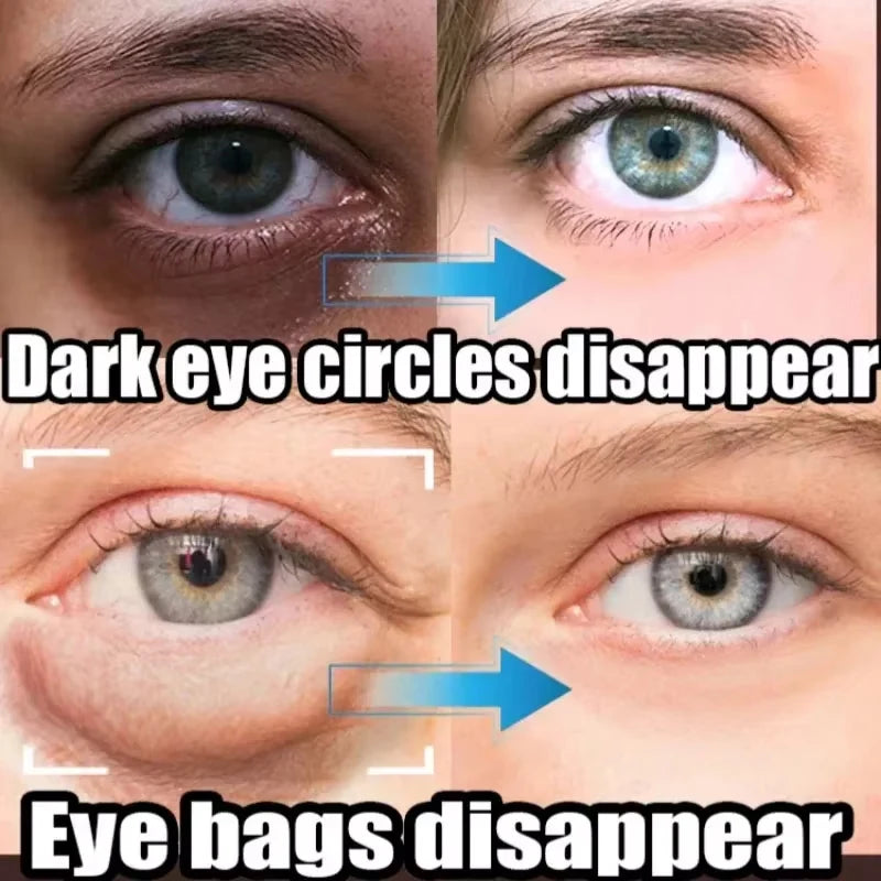كريم جل العين يحتوي على الريتينول بتركيبة متقدمة تساعد في تقليل التجاعيد وشد البشرة حول العين.