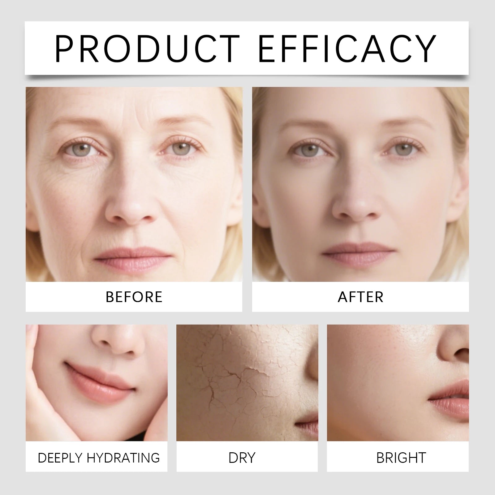 Hyaluronic Acid Stock Solutions Face Serum with Roller Microneedle Set Moisturizing Anti-Wrinkle Facial Serum Smoothing Refresh