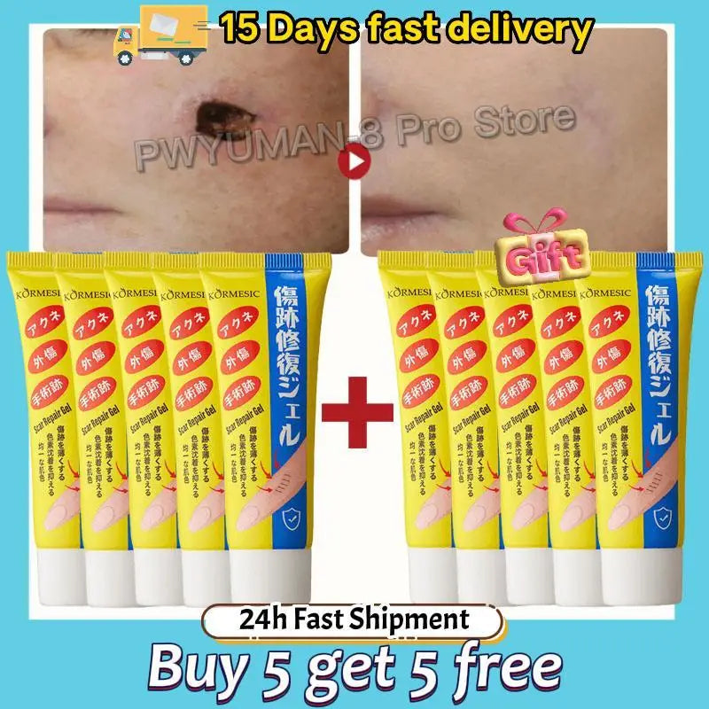 Fast Scar Removal Cream Treatment Stretch Marks Burn Surgical Scar Acne Spots Repair Gel Whitening Moisturizing Smooth Skin Care