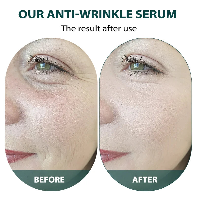 Bosein Wrinkle Firming Serum Fade Fine Lines ngredient Repairing Moisturizing Nourishing Korea Face Anti-aging Skin Care