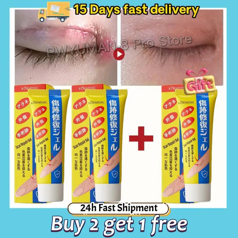 Fast Scar Removal Cream Treatment Stretch Marks Burn Surgical Scar Acne Spots Repair Gel Whitening Moisturizing Smooth Skin Care