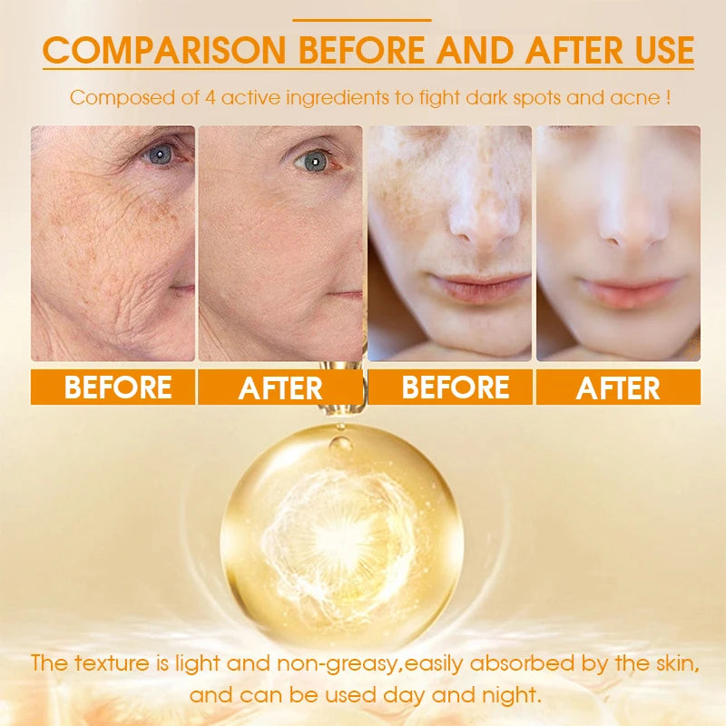 Dark Spot Facial Serum Turmeric Essence Remove Dark Spots Melasma Niacinamide Brighten Lighten Melanin Skin Care Products