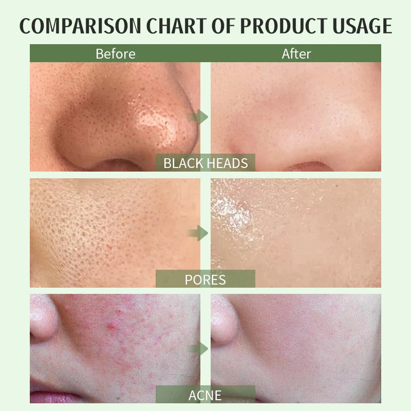 New Green Tea Mud Mask 80g Anti-acne Improve Pore Deep Cleaning Facial mask Apply face mask Oil Control Skin Care Product