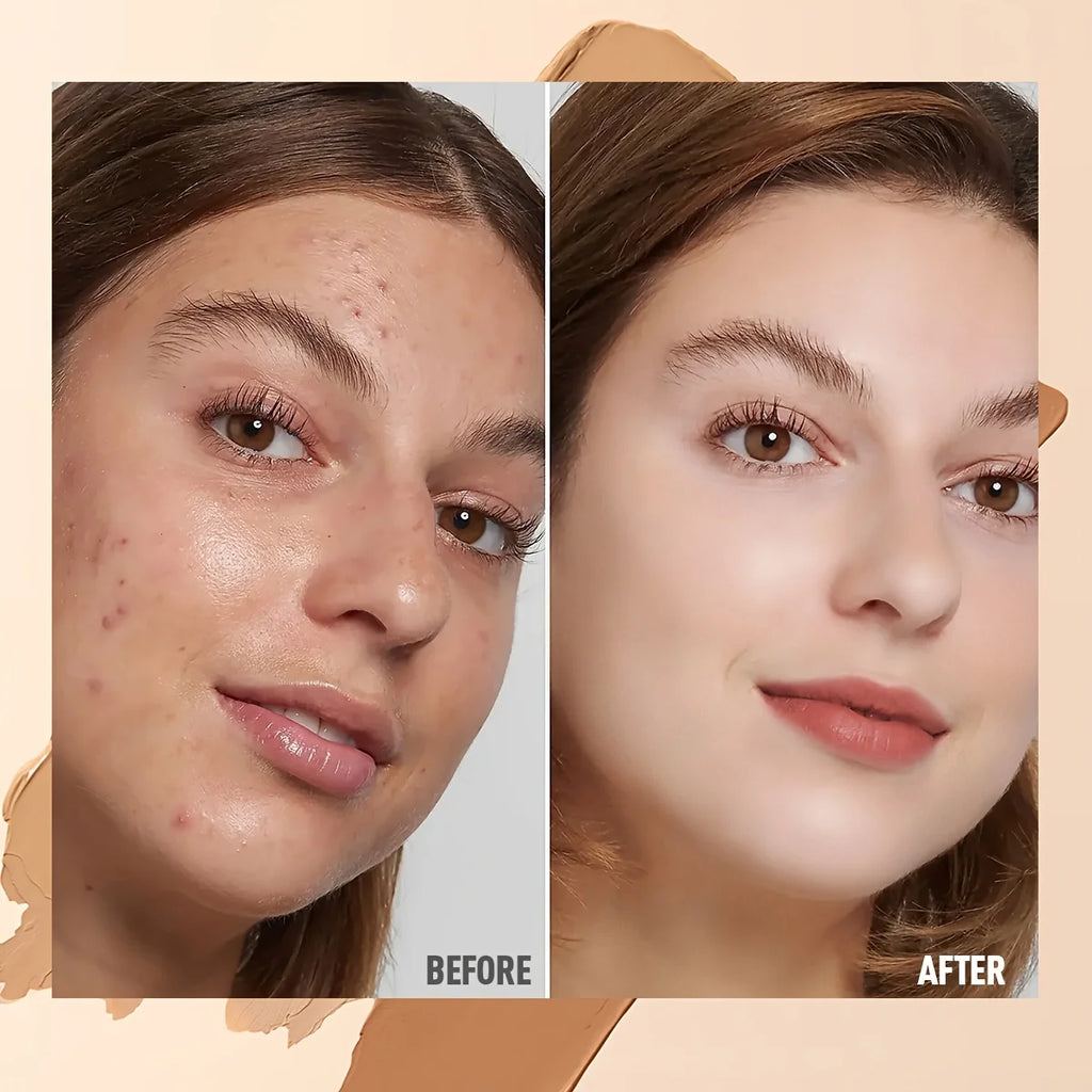 Waterproof Long Lasting Full Coverage for Acne Mark Dark Circles Eye Contour Concealer Palette Moisturizing Face Makeup