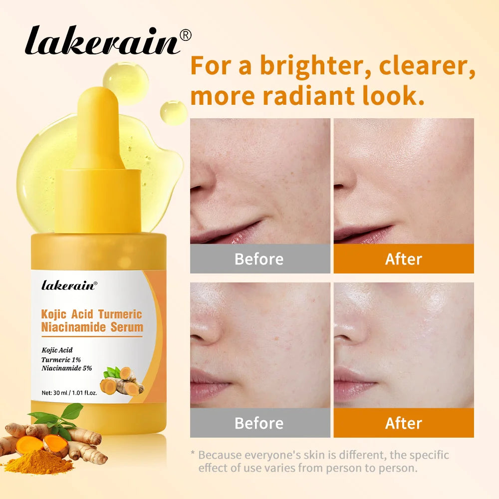 Kojic Acid Turmeric Niacinamide Serum Precise Dropper Design Deep Moisturizing Soothe Skin Brighten Skin Tone Facial Care