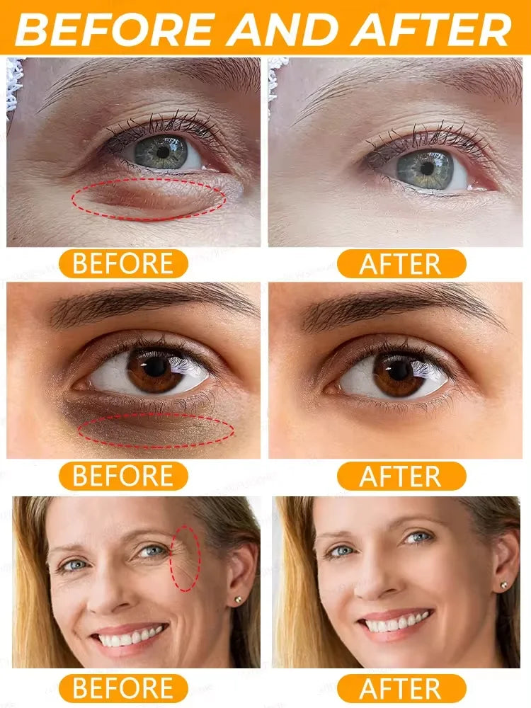 كريم جل العين يحتوي على الريتينول بتركيبة متقدمة تساعد في تقليل التجاعيد وشد البشرة حول العين.