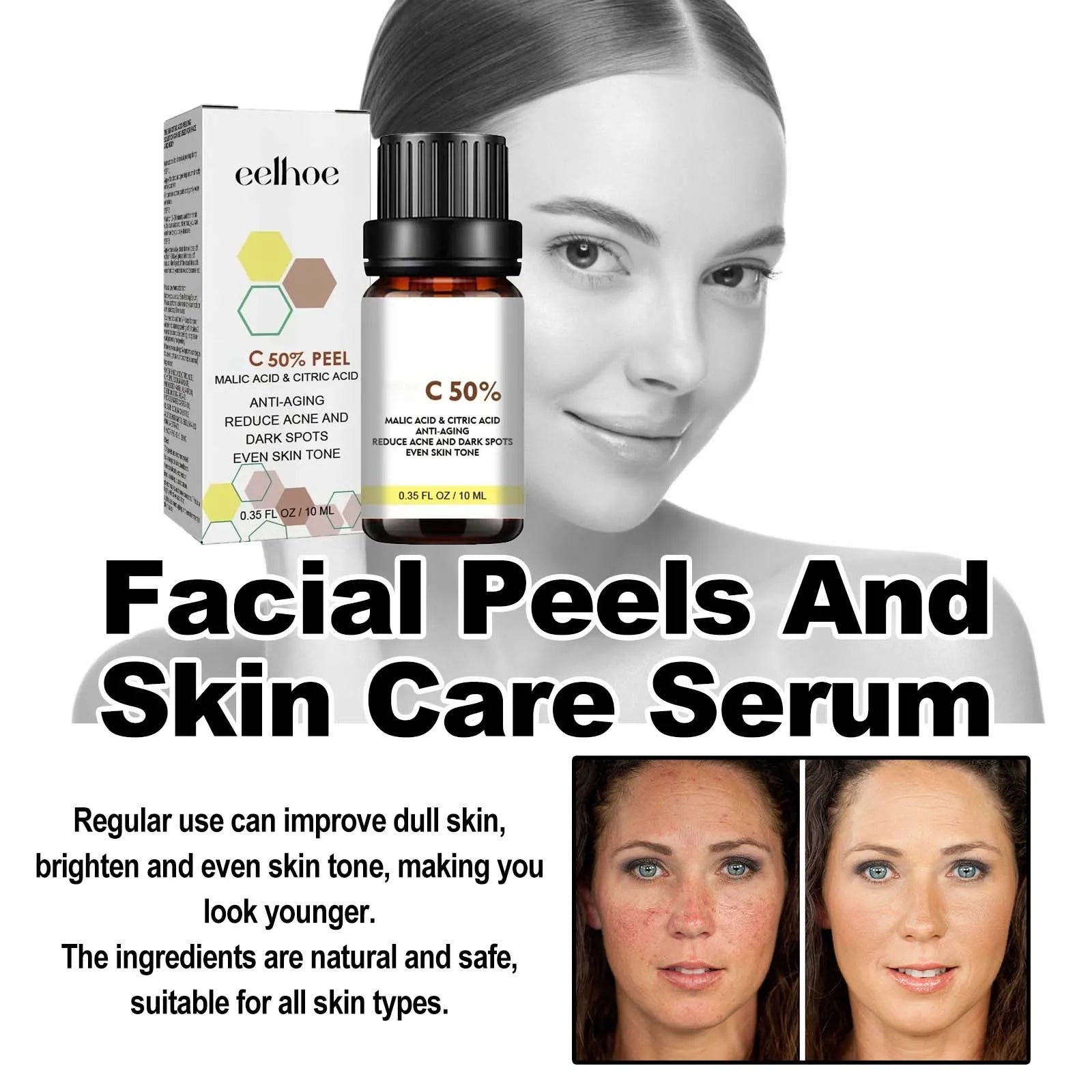 Fade and Dark Spots Anti-aging Essence Chemical Exfoliants Moisturizer Face Oils Salicylic Acid Face Peel Neutraliser
